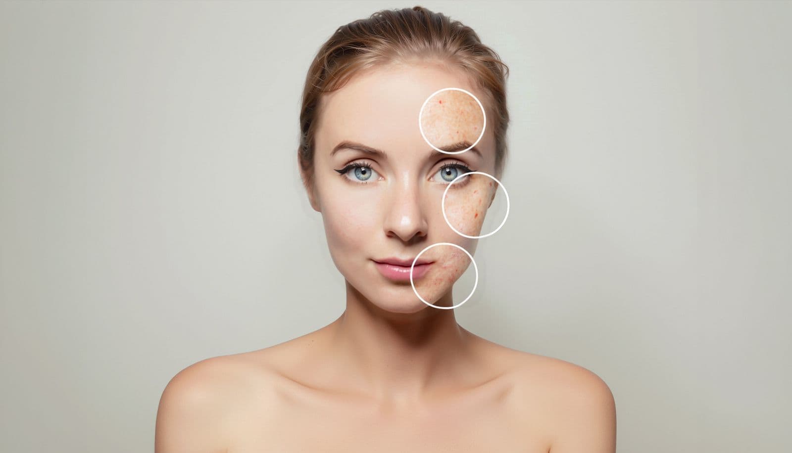 General Approach to Spot Treatment