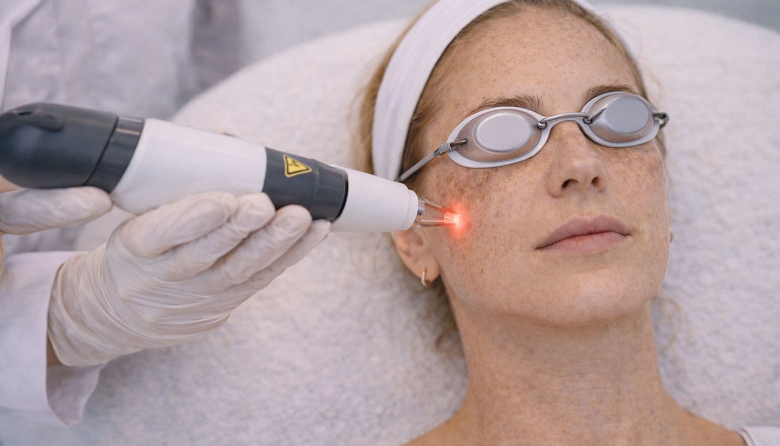 Laser Spot Treatment